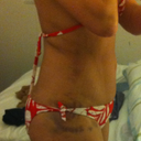 12 days post op side
