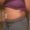 Side View- 4week post op