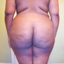 Pre-Op been working out.....