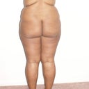 Pre Op flat, square, pancake booty SMH