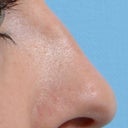 old nose