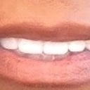 Loving my smile