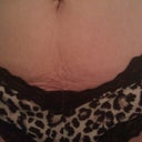 Pre opt pic front of "belly hang"