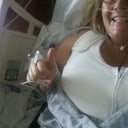 Right after surgery