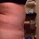see the upper tummy sticks so far out it looks like a wave big small then big