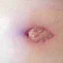 BB is healing well. Still not sure if that hole at the top will stay or close though.
