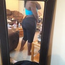 2 weeks post op excuse my dirty living room lol