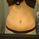 Before (weight 155)