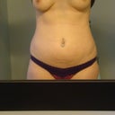 Before (weight 155)