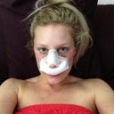 Day 1 after surgery!!