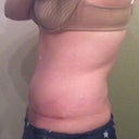 WK 12 AM swelling comparison