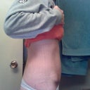 PO Day 7More swollen on my right side.