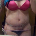 soooo swollen :(
