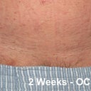 2 weeks after