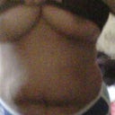 Last time without that scar