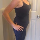 Five weeks post op