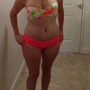 Five weeks post op