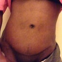 Swell hell go away even at 6 wks 6 days po.