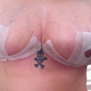 One month post op...nipples have came up a bit