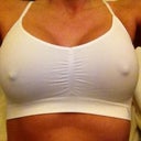 Post op 8 days