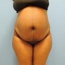 Before TT and Lipo