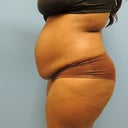 Before TT and Lipo