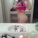 1 day post op......I can see the difference already.