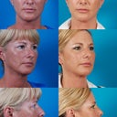 before and after photos