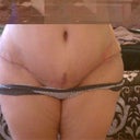 5 wks 5 days. my incision. I think it looks pretty good. Is that a mini dog ear on the rt? Hmmmm