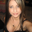 Before rhinoplasty