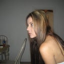 2 weeks after rhinoplasty