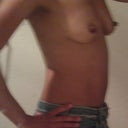 Pre - Surgery
