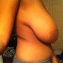 before side