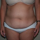 Front before