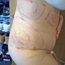 At 5 days, side view, dont mind the marker