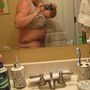 2 week's post-op