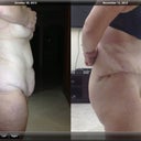 before and after