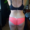 7 Weeks Post OP