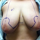 After markings