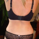 14 WEEKS POST OP