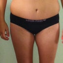 this is 1 day before surgery - this is how wide my wait line was!