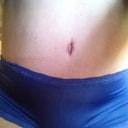 still some redness from bb scar