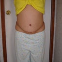 1 month post front
Early Morning before I swell up