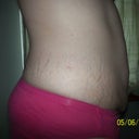 pre op