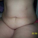 pre op