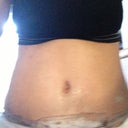 Pod 16 Swelling gone down tremendously