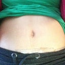 Pod 16 My belly button going in little by little thanks to the dressing.
