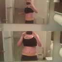 twelve days post op, the swelling has finally started going way down!