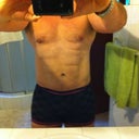 2 Years Post Vaser Liposuction