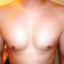 3 months and 3 weeks post op!